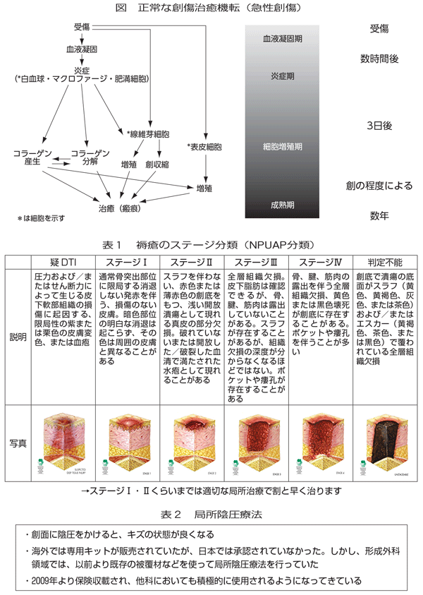 ステージ 褥瘡 画像でみる褥瘡（床ずれ）―その原因とは？