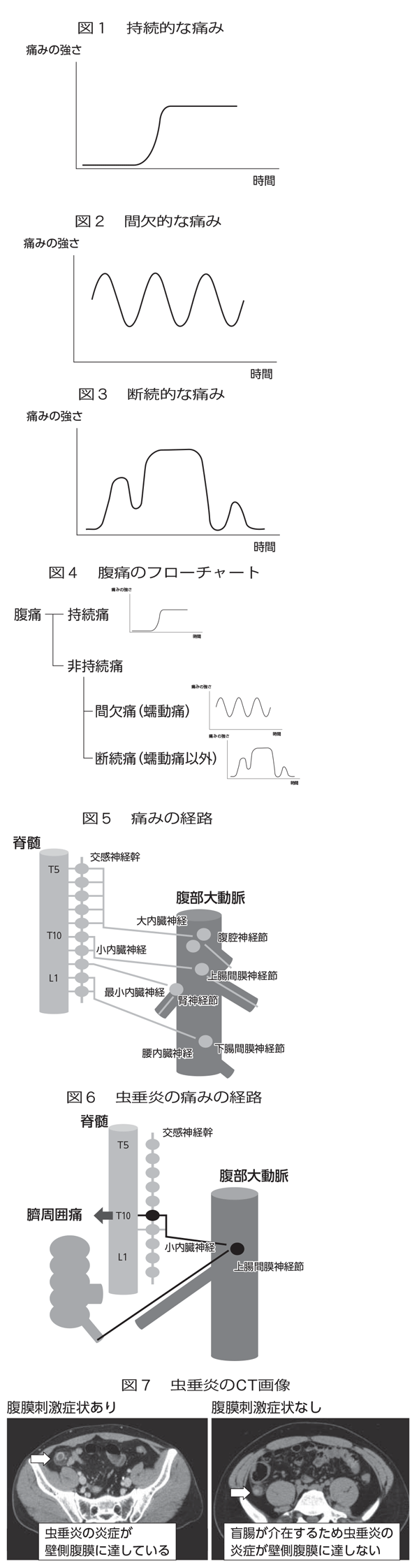 右 下腹 痛い