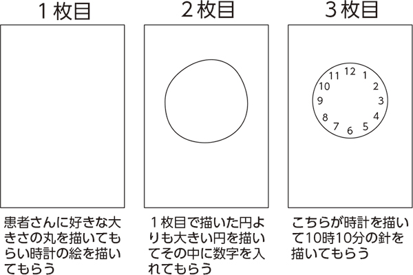 認知 症 テスト 絵