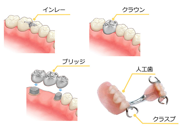 金パラ